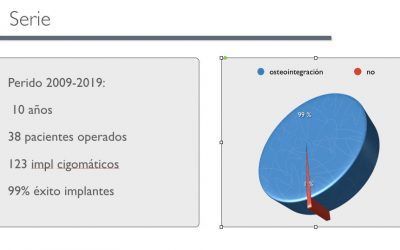 GBCOM consigue un 99% de osteointegración en sus implantes Cigomáticos durante los últimos 10 años